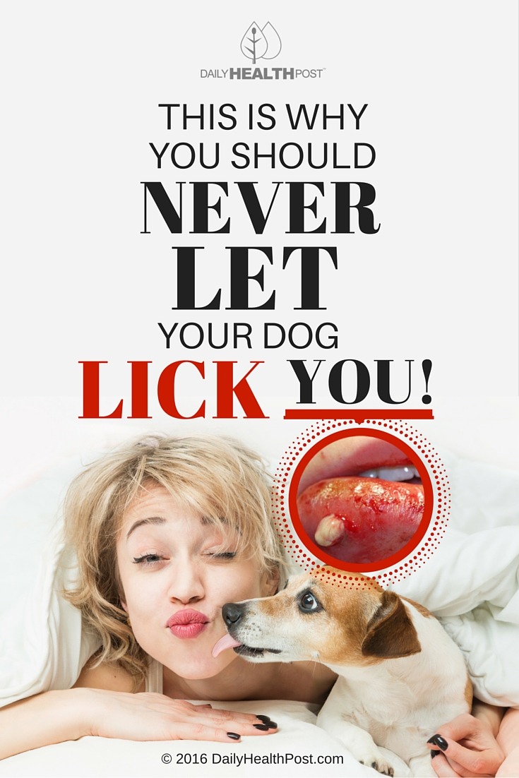 03 This Is Why You Should Never Let Your Dog Lick You! (3)