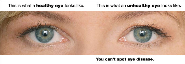 eye exam