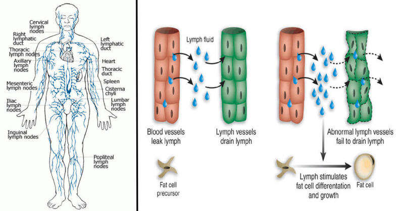 Lymph Leakage May Be The Cause Of Obesity