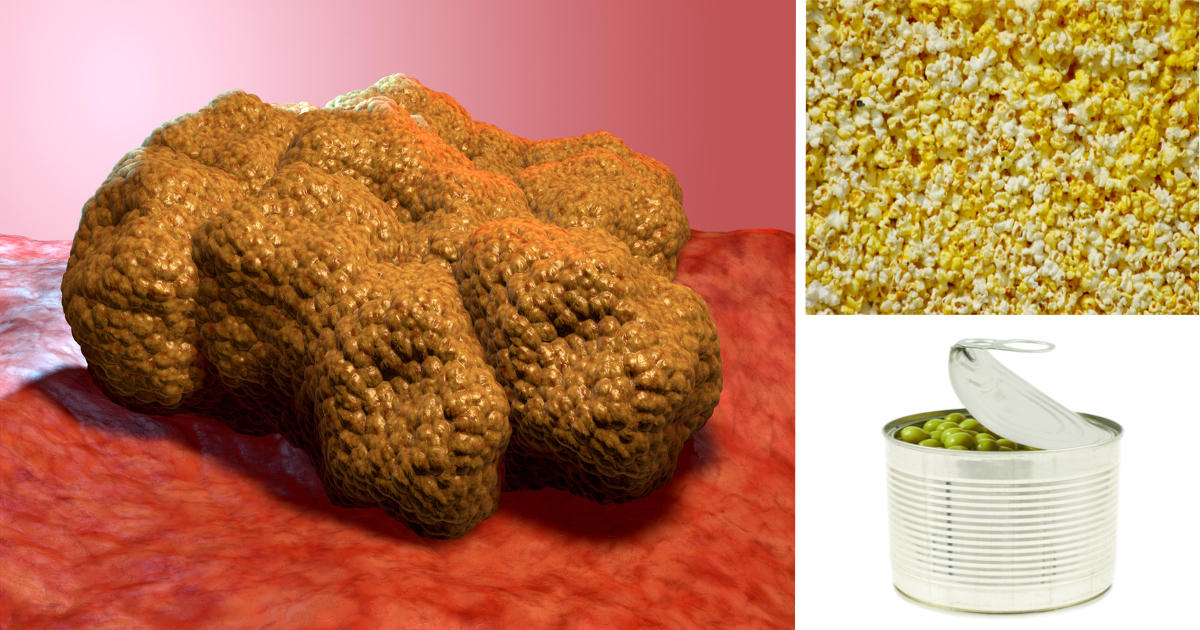 These Foods Make Cancer Cells Grow In Your Body! Stop Eating Them Right