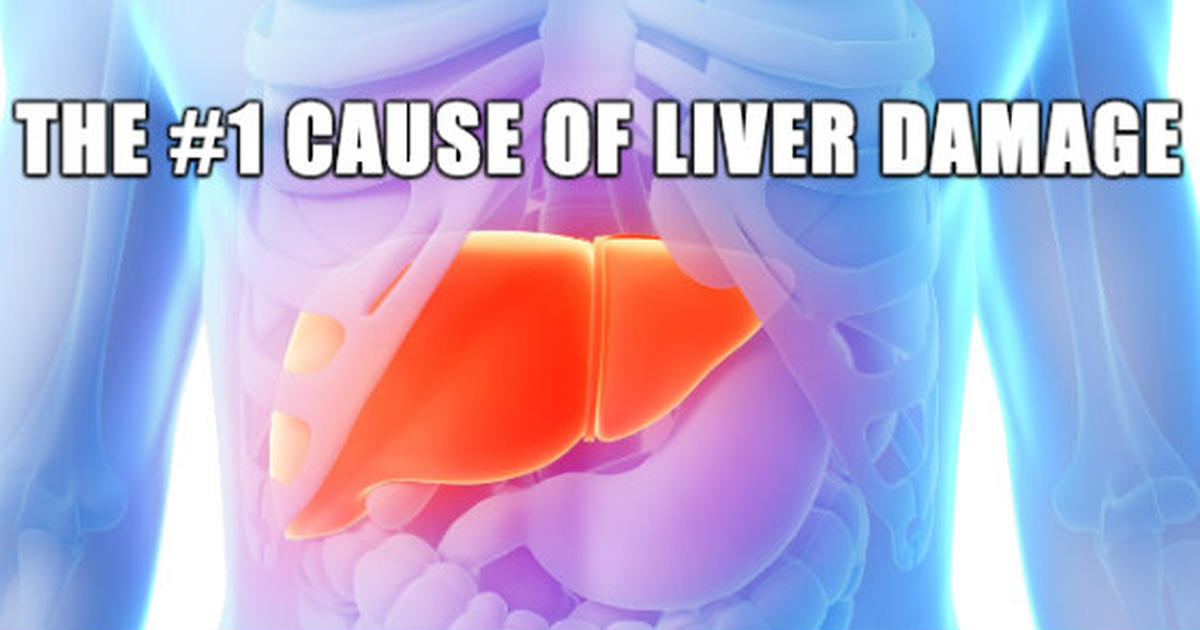 Beware of The 1 Cause of Acute Liver Damage DailyHealthPost