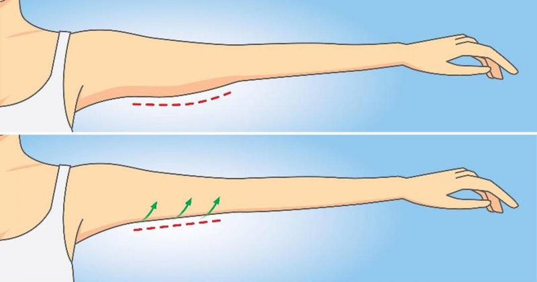 7 Key Moves That Get Rid Of Stubborn Arm Fat DailyHealthPost