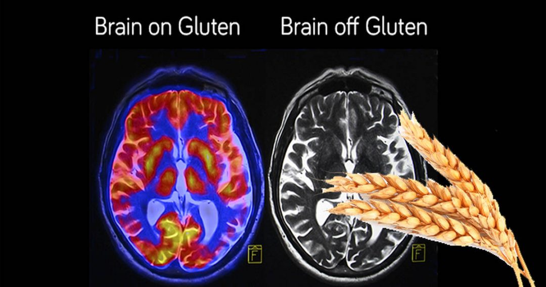 New Study Links Gluten And Migraine Occurence: Your Brain On Grain