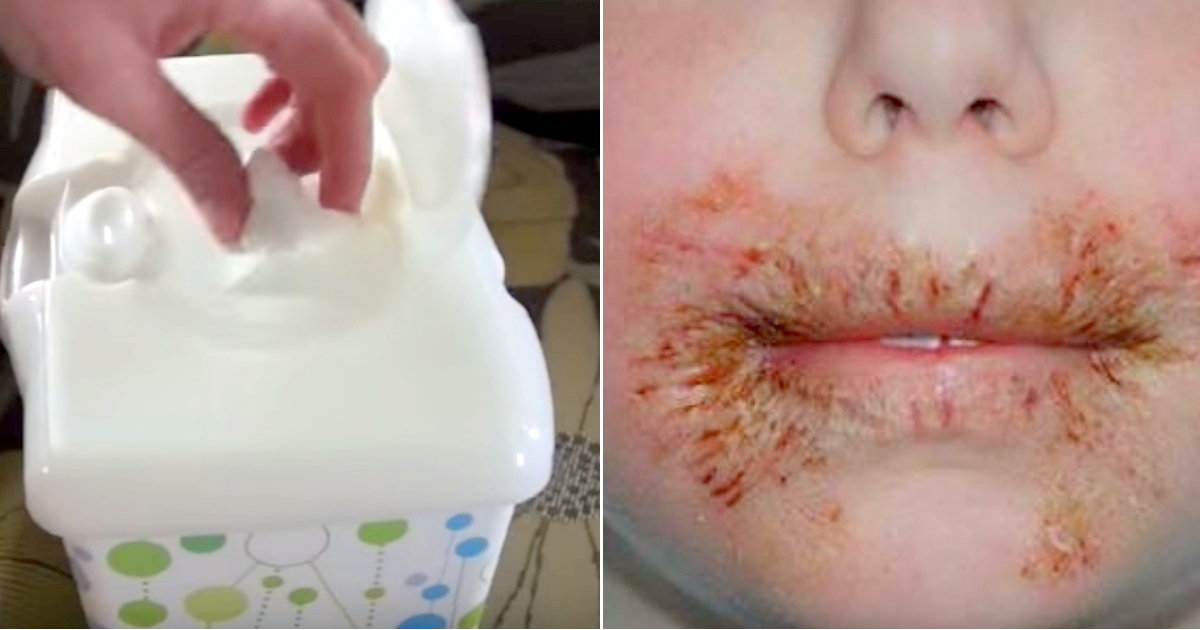 Doctor’s Warning Check Baby Wipes Label For Possible Chemical That May Cause Rashes