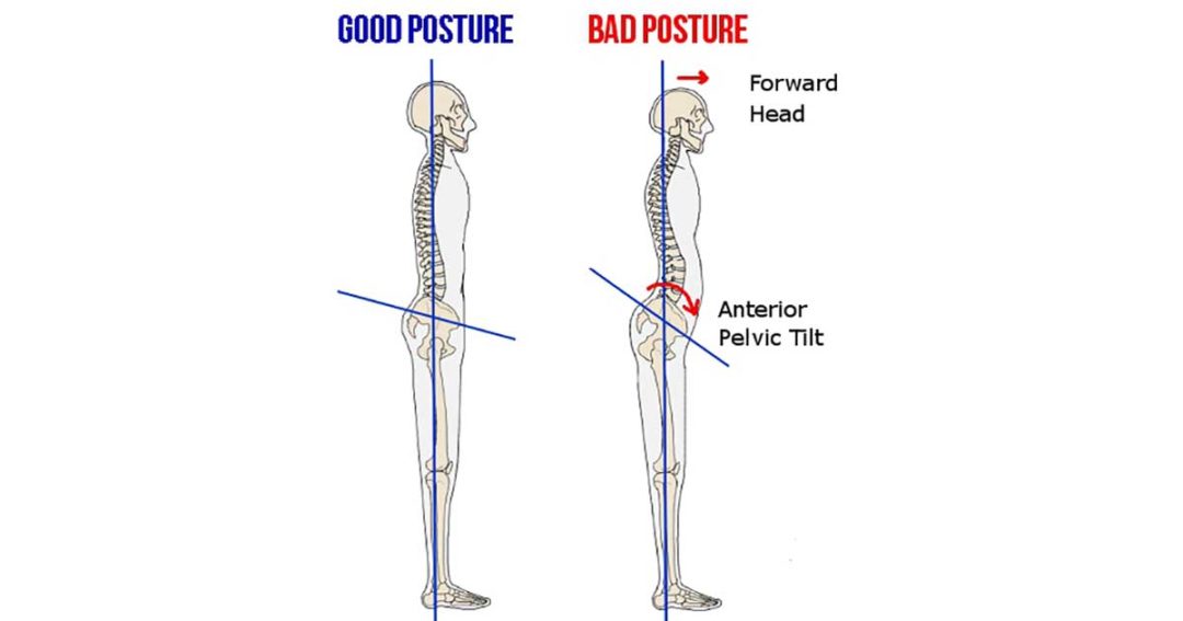 How To Correct An Anterior Pelvic Tilt With These 13 Stretches