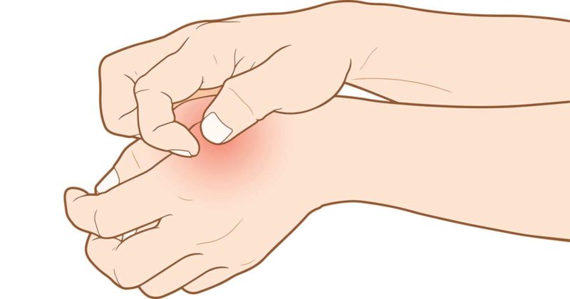 Painless Trick To Remove Stubborn Splinters In Your Skin Using Only a ...
