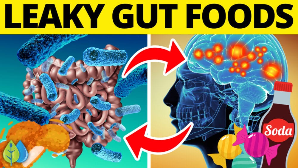 Top 8 Foods Causing Leaky Gut (and Leaky Brain) DailyHealthPost