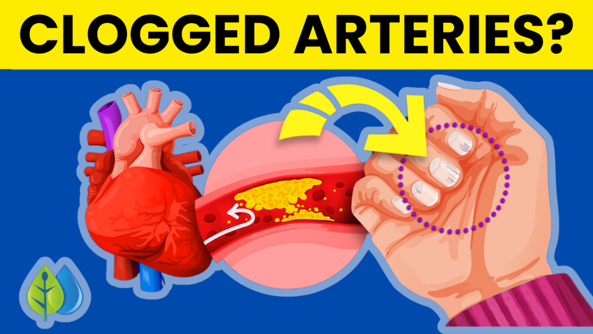 Top 10 Signs of Peripheral Artery Disease (PAD) symptoms, causes