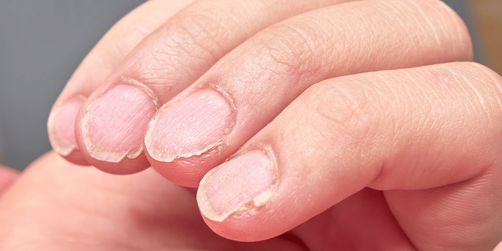 Vertical Nail Ridges? Here’s What Causes Them — And How To Fix It
